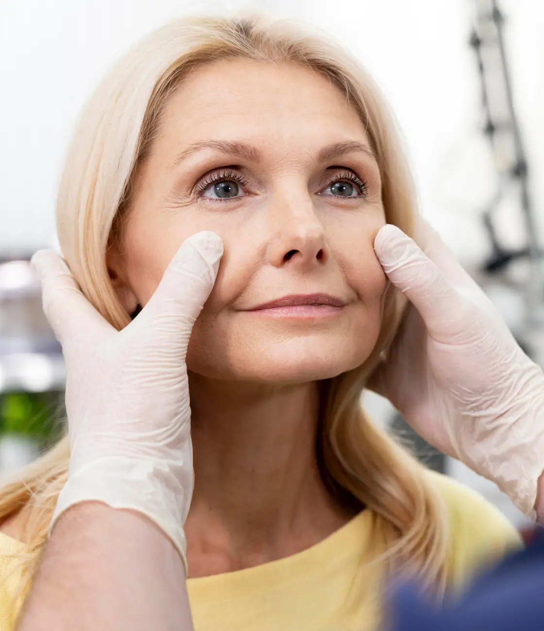 Blefaroplastia en Madrid