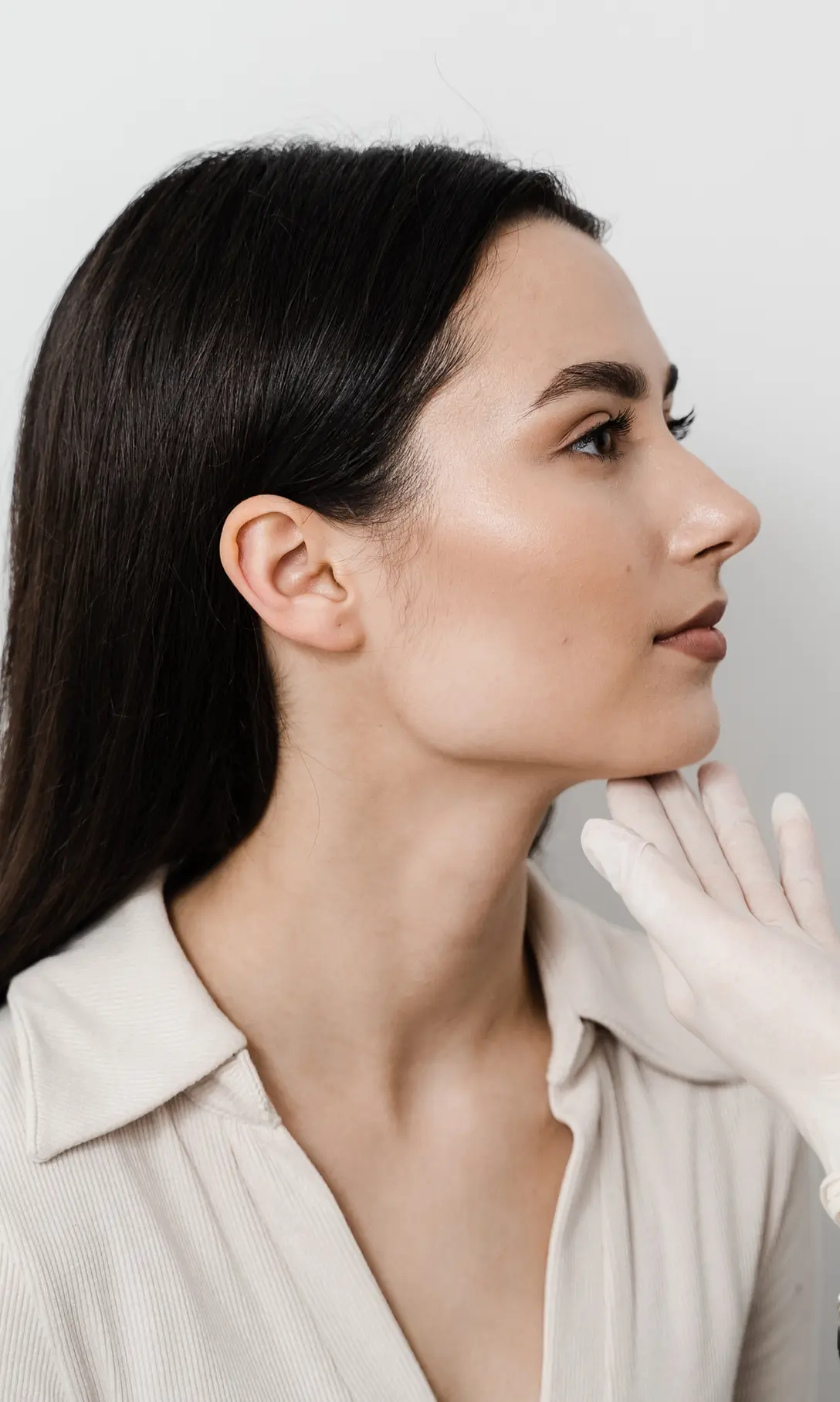 Paciente Liposucción de Papada