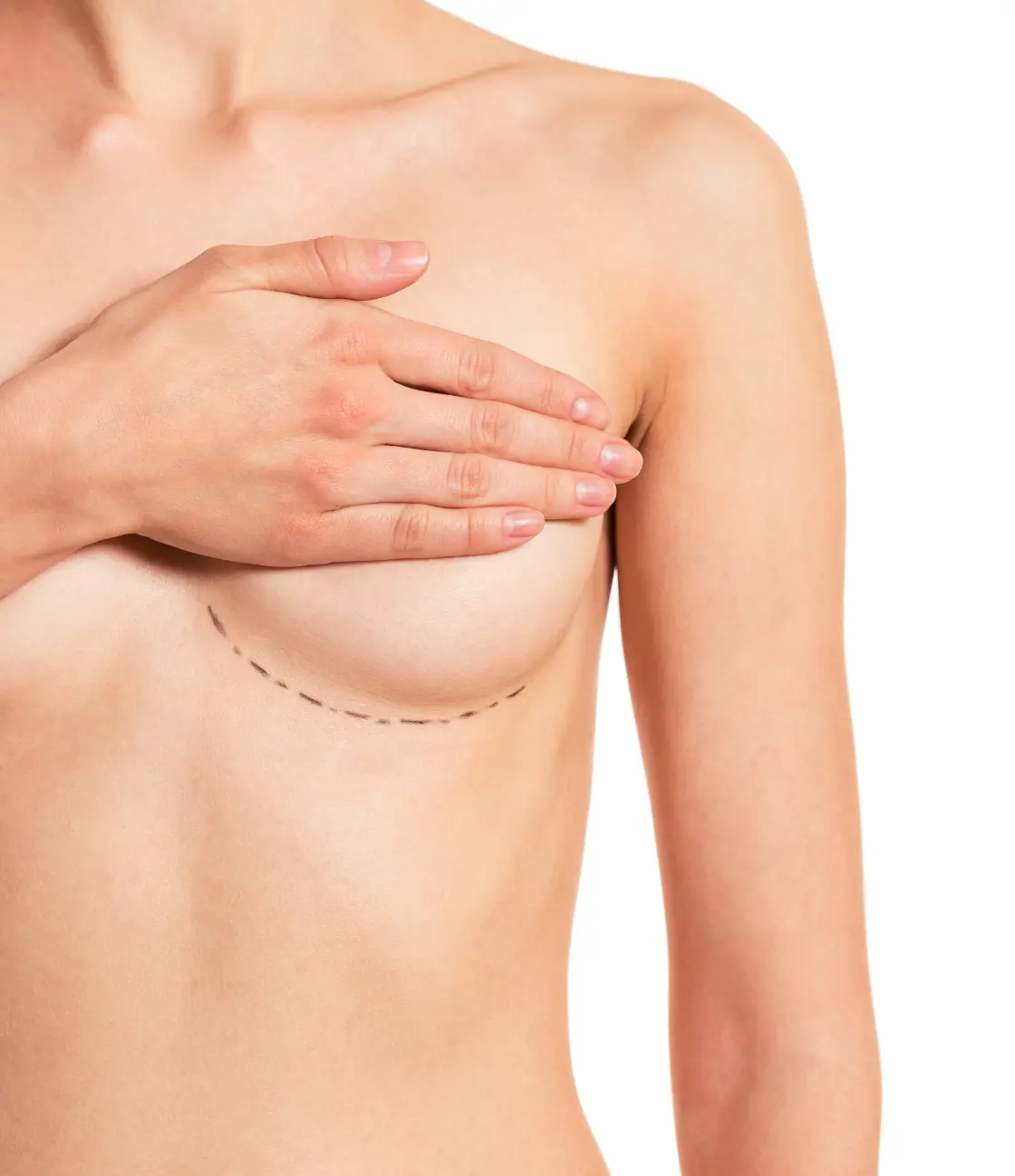 Reducción de pecho en Madrid