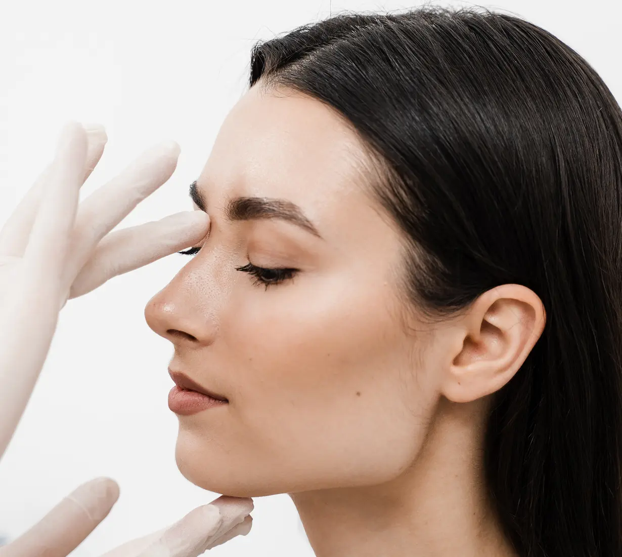 Cirugia de Rinoplastia en Madrid