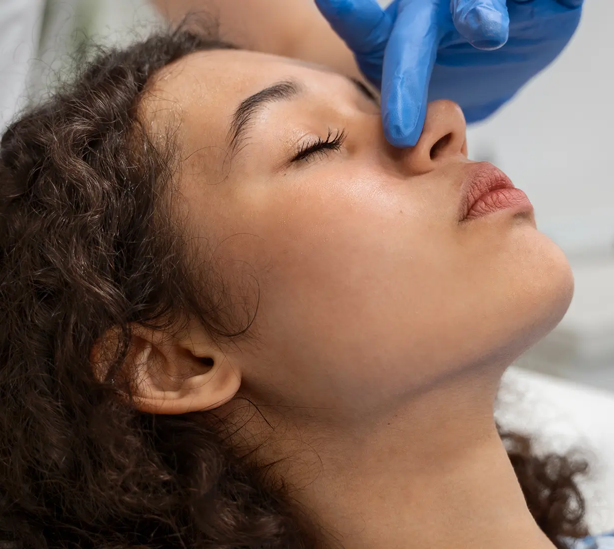 Rinoplastia estética