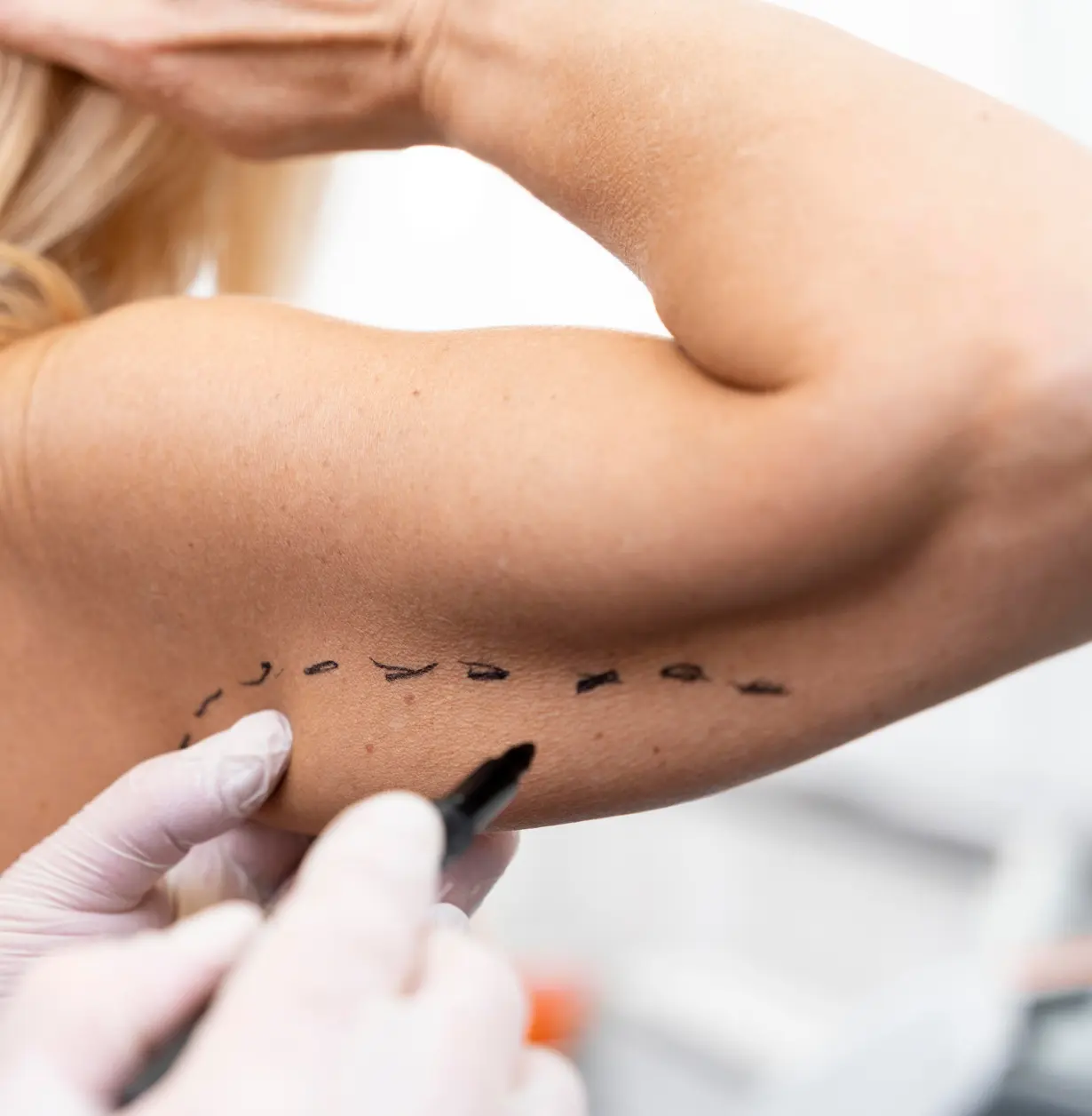 Lifting de brazos y piernas